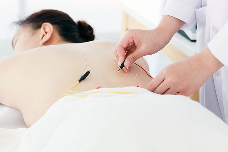 Trigger Point Dry Needling
